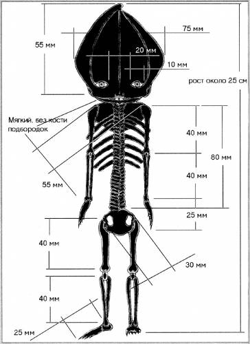 Черно-белая схема показывает анатомию Алёшеньки